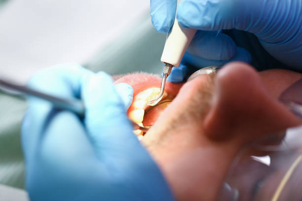 Best Cosmetic Emergency Dentistry in Southgate, MI